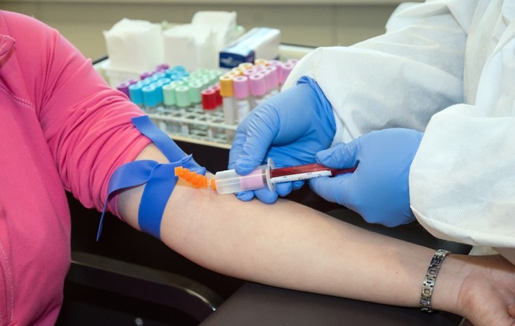 antitijela-krv laboratorija