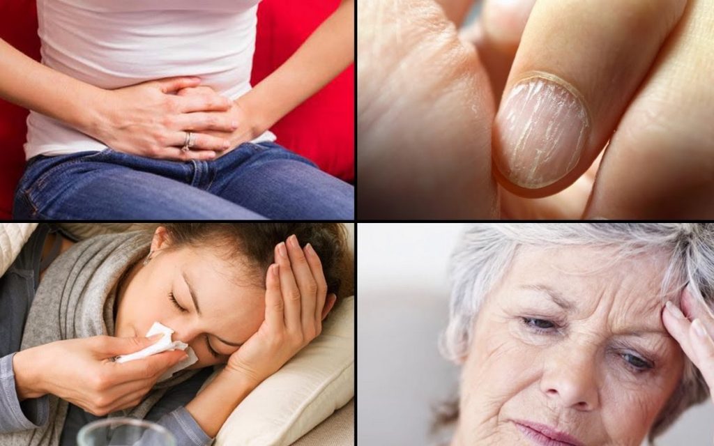 anemija-simptomi-gvožđe-željezo