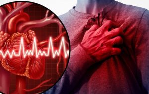 srcani-udar-ilustracija-872x410