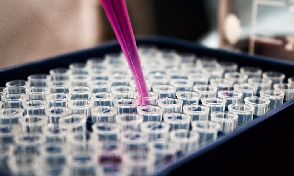 istrazivanje-doktori-matićne-ćelije